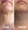 RevitaFirm™ | Für eine jugendlich straffe haut!